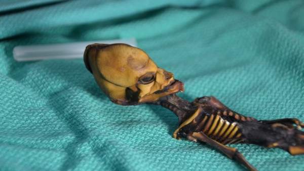 El Esqueleto De Atacama Es De Una Bebe Con Raras Mutaciones No De Un Alien, Misterio y Ciencia en Planeta Incógnito: Revista web y podcast